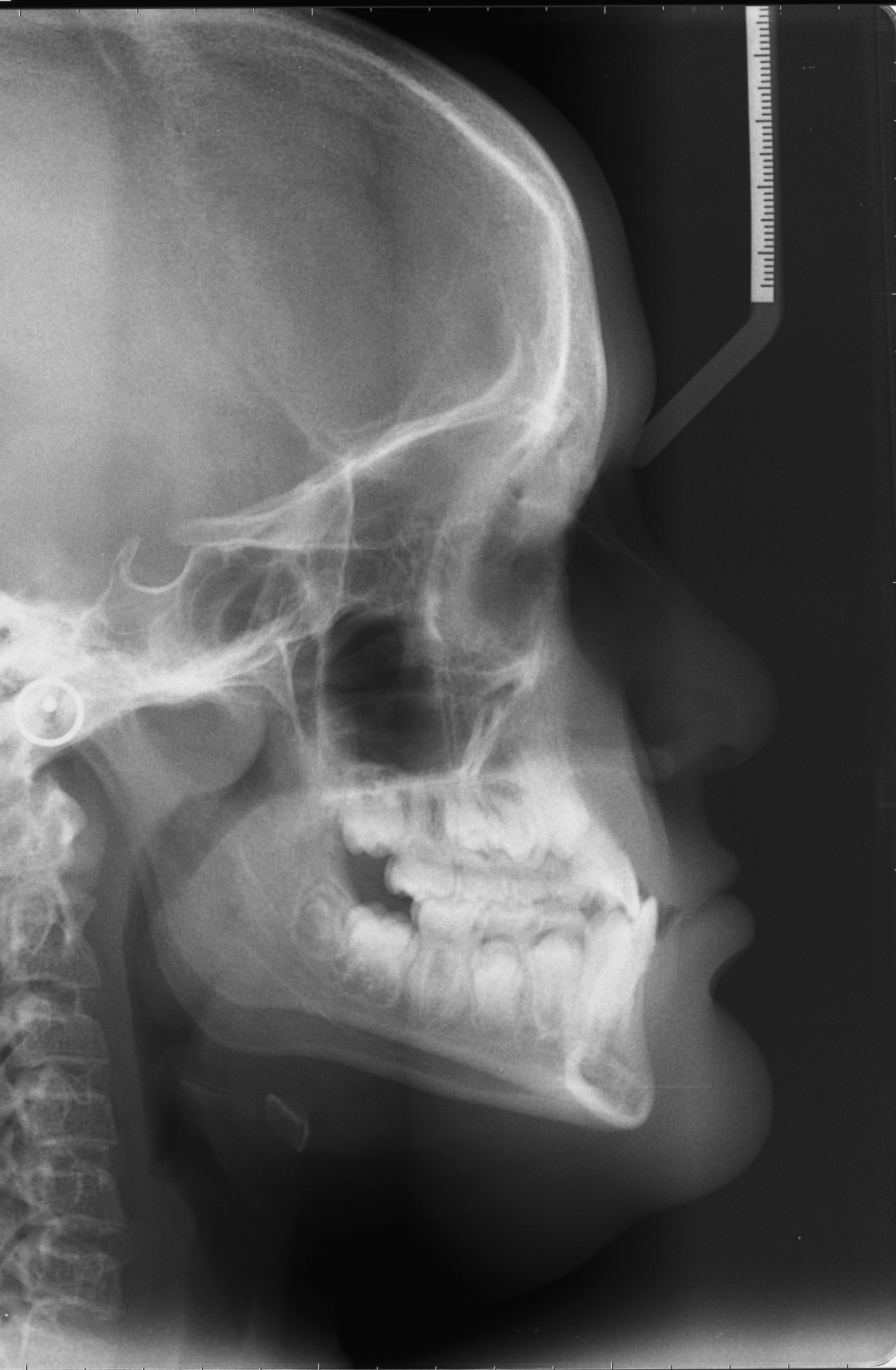 cephalometric x ray