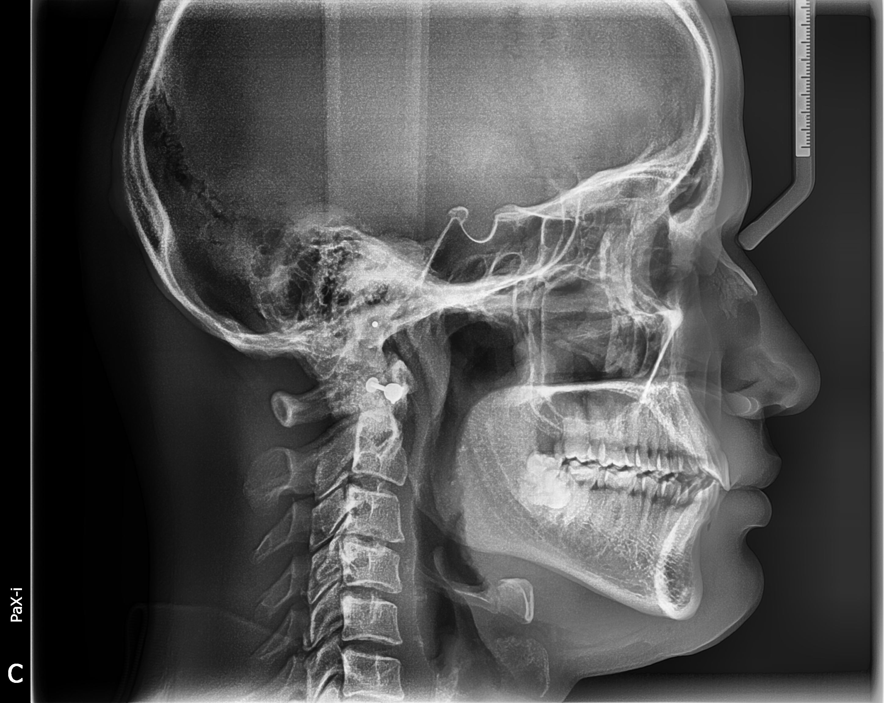 cephalometric x ray